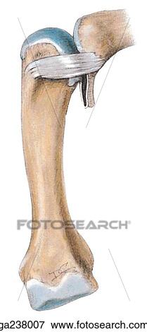 Lateral view of the flexed metacarpophalangeal joint, showing the palmar ligament. View Large Illustration Stock Illustration - Lateral view of the flexed metacarpophalangeal joint, showing the palmar ligament.. Fotosearch