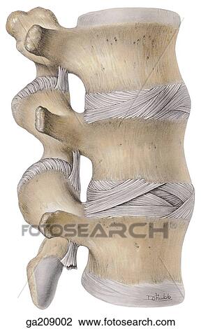 Drawing - Lateral view of the intervertebral disc, with sections removed to show direction of fibers; the anulus fibrosus is shown dissected.. Fotosearch