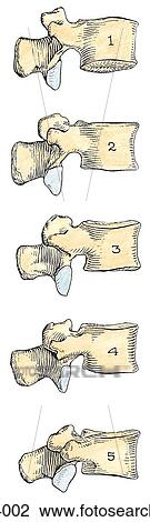 Lateral view of the lumbar vertebrae. View Large Illustration Drawing - Lateral view of the lumbar vertebrae.. Fotosearch