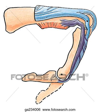 Stock Illustration - Lateral view of the retinacular ligament in flexed digit.. Fotosearch