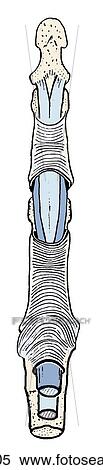 Stock Illustration - Long flexor tendons and their fibrous sheaths. Fibrous digital flexor sheath showing the two osseofibrous tunnels.. Fotosearch