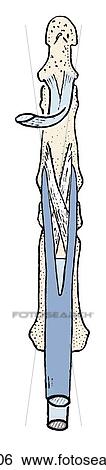 Stock Illustration - Long flexor tendons and their fibrous sheaths. Mode of insertion of the long digital flexors.. Fotosearch