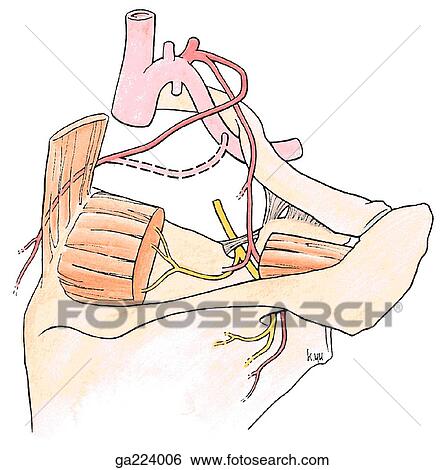 Stock Illustration - Posterosuperior view of the suprascapular and dorsal scapular arteries.. Fotosearch
