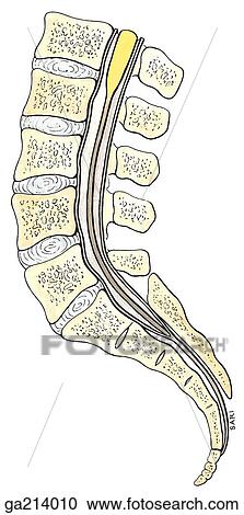 Clipart - Sagittal section of termination of spinal cord, in situ; image also shows conus medullaris, filum terminale, and subarachnoid space.. Fotosearch