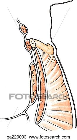 Sagittal section of the anterior wall of axilla and clavipectoral fascia. View Large Illustration Drawing - Sagittal section of the anterior wall of axilla and clavipectoral fascia.. Fotosearch
