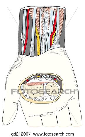 Structures at anterior aspect of wrist. Bony landmarks of arm and forearm regions. Inset shows pertinent tendons, vessels and nerves on transverse section. View Large Illustration Stock Illustration - Structures at anterior aspect of wrist. Bony landmarks of arm and forearm regions. Inset shows pertinent tendons, vessels and nerves on transverse section.. Fotosearch