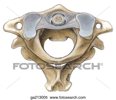 Superior view of the atlanto-occipital and atlantoaxial joints, including the tubercle of atlas, vertebral canal, spinous process of axis, and dens of atlas. View Large Illustration Stock Illustration - Superior view of the atlanto-occipital and atlantoaxial joints, including the tubercle of atlas, vertebral canal, spinous process of axis, and dens of atlas.. Fotosearch