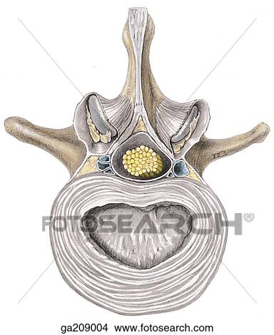 Stock Illustration - Superior view of transverse section of the intervertebral disc and ligaments, with the nucleus pulposus removed and the epiphyseal plate exposed.. Fotosearch