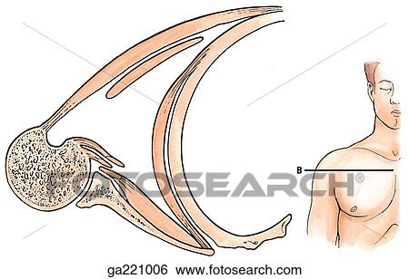 Transverse section of the axilla. The insert indicates the level dissection. View Large Illustration Stock Illustration - Transverse section of the axilla. The insert indicates the level dissection.. Fotosearch