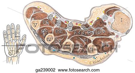 Transverse section through adductor pollicis; for level of section, see insert (line A). View Large Illustration Drawing - Transverse section through adductor pollicis; for level of section, see insert (line A).. Fotosearch