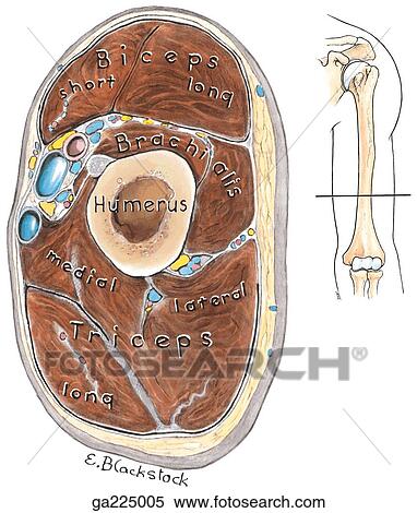 Stock Illustration - Transverse section through arm; insert image shows level of transverse section.. Fotosearch