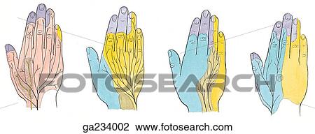 Variations in patterns of cutaneous nerves in dorsum of hand. View Large Illustration Drawing - Variations in patterns of cutaneous nerves in dorsum of hand.. Fotosearch
