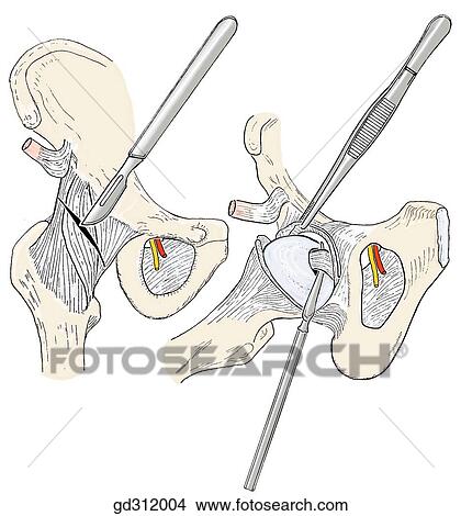 Anterior portion of hip joint. View Large Illustration Stock Illustration - Anterior portion of hip joint.. Fotosearch