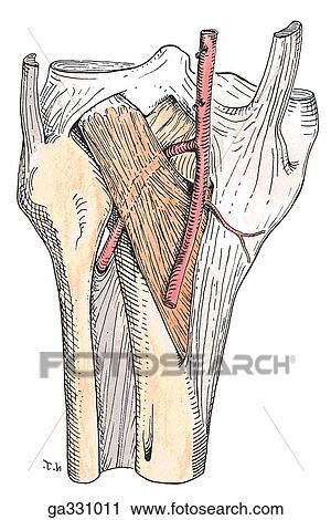 Clip Art - Arterial anomalies of posterior leg, posterior view. B. High division of popliteal artery. Along with the anterior tibial artery descending anterior to the popliteus muscle, this anomaly was found to occur in approximately 2% of limbs.. Fotosearch