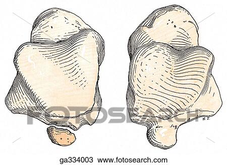 Drawing - Bony anomalies. C. Os trigonum, superior view. The lateral (posterior) tubercle of the talus has a separate center of ossificaiton, which appears from the ages 7 to 13 years.; when this fails to fuse with the body of the talus, as in the left bone of this. Fotosearch