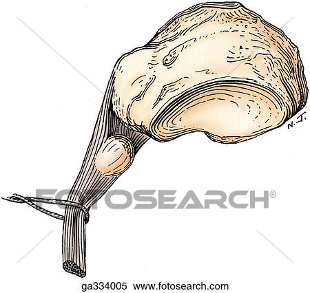 Bony anomalies. D. Sesamoid bone in tibialis posterior, posterior view. A sesamoid bone was found in 23% of 348 adults. View Large Illustration Stock Illustration - Bony anomalies. D. Sesamoid bone in tibialis posterior, posterior view. A sesamoid bone was found in 23% of 348 adults.. Fotosearch