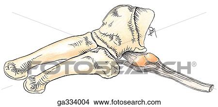 Stock Illustration - Bony anomalies. E. Sesamoid bone in fibularis (peronus) longus, lateral view. A sesamoid bone was found in 26% of 92 feet. In this specimen, it is bipartite, and the fibularis (peronus) longus muscle has an additional attachment to the fifth metatarsal bo. Fotosearch