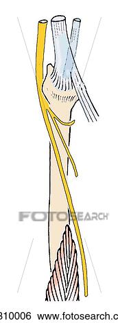 Common fibular (peroneal) nerve and its branches in contact with fibula. View Large Illustration Stock Illustration - Common fibular (peroneal) nerve and its branches in contact with fibula.. Fotosearch