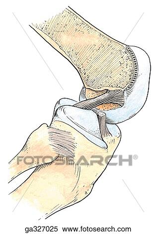 Cruciate Ligaments. A. Posterior cruciate ligament, lateral view. View Large Illustration Stock Illustration - Cruciate Ligaments. A. Posterior cruciate ligament, lateral view.. Fotosearch