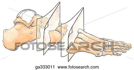 Clip Art - Cuneonavicular, cubonavicular and tarsometatarsal joints. A. Bones of foot, lateral view.. Fotosearch