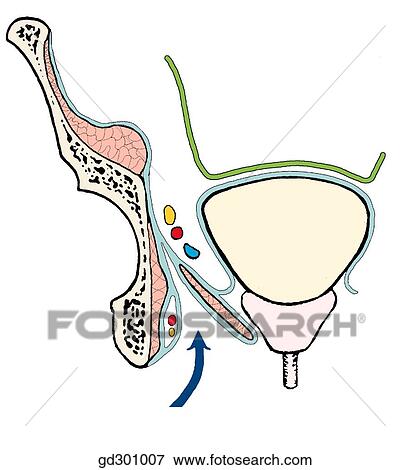 Stock Illustration - Diagram of pelvic fascia (male pelvis, coronal section).. Fotosearch