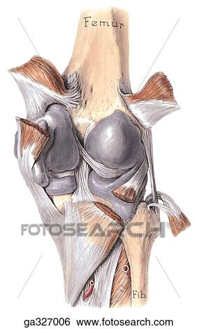 Stock Illustration - Distended knee joint, posterior view.. Fotosearch