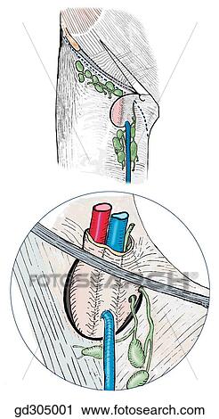 Fascia lata with saphenous opening, femoral sheath and superficial