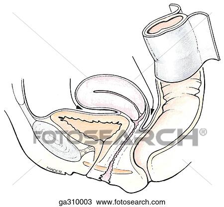 Drawing - Female peritoneum covering female pelvic organs, median section.. Fotosearch