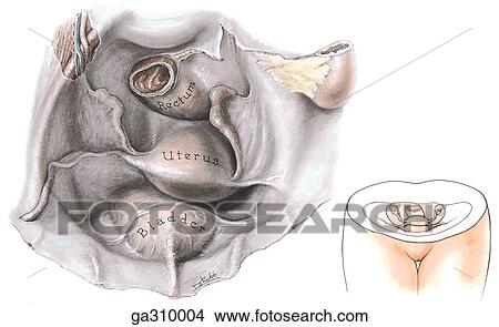Female true pelvis, superior view. Insert image indates level of disection. View Large Illustration Stock Illustration - Female true pelvis, superior view. Insert image indates level of disection.. Fotosearch