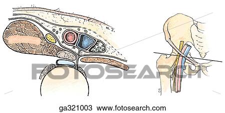 Femoral sheath. B. Transverse section through femoral vessels and nerve. Note that the psoas major tendon separates the femoral artery from the hip joint. Insert image indiates level of dissection. View Large Illustration Drawing - Femoral sheath. B. Transverse section through femoral vessels and nerve. Note that the psoas major tendon separates the femoral artery from the hip joint. Insert image indiates level of dissection.. Fotosearch