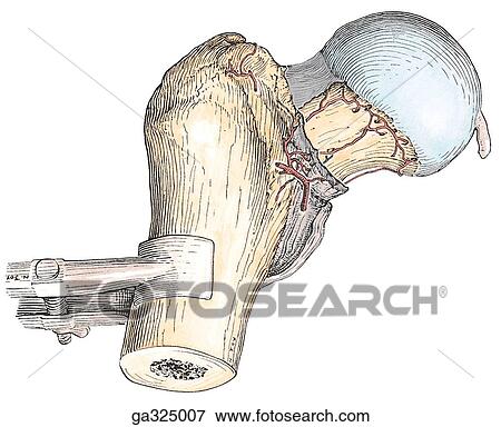 Stock Illustration - Head of femur blood supply. C. Anterior view.. Fotosearch