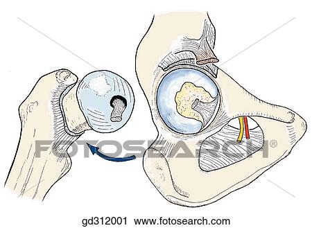 Head of femur removed from acetabular fossa. View Large Illustration Clip Art - Head of femur removed from acetabular fossa.. Fotosearch