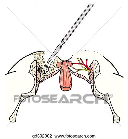 Drawing - Ischioanal fossa and anus on coronal section (specimen in prone position).. Fotosearch