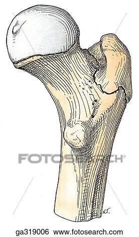 Stock Illustration - Lower Limb Development. B. Posterior view. Epiphyses at proximal end of femur, posterior view. The epiphyses of the head begins to ossify during the first year, that of the great trochanter before the 5th year, and that of the lesser trochanter before the. Fotosearch