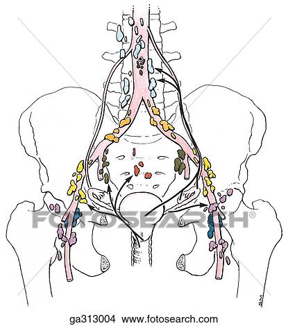 Лимфатический Узел Паховая Область Влагалище Шишка