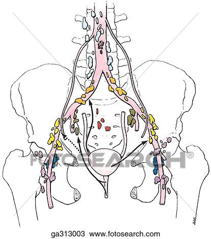 Lymphatic drainage of female pelvis, anterior views. A. Ureters, urinary bladder and urethra. View Large Illustration Drawing - Lymphatic drainage of female pelvis, anterior views. A. Ureters, urinary bladder and urethra.. Fotosearch