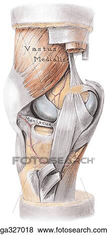 Medial aspect of knee. A. Dissection. The band-like part of the tibial collateral ligament attaches to the medial epicondyle of the femur, is almost aligned with the tendon of the adductor magnus muscle, bridges superficial to the insertion of the semimem View Large Illustration Stock Illustration - Medial aspect of knee. A. Dissection. The band-like part of the tibial collateral ligament attaches to the medial epicondyle of the femur, is almost aligned with the tendon of the adductor magnus muscle, bridges superficial to the insertion of the semimem. Fotosearch