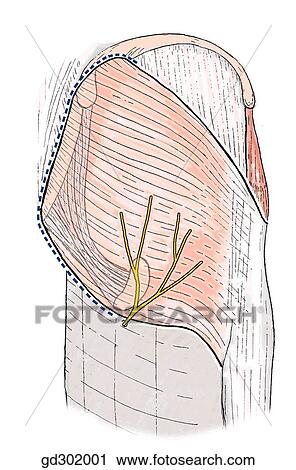 Clip Art - Partially detach and reflect the gluteus maximus muscle to expose the nerve and the vessels to the ischioanal fossa.. Fotosearch