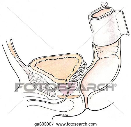 Stock Illustration - Peritoneum covering male pelvic organs, median section.. Fotosearch