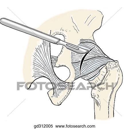 Posterior portion of hip joint. View Large Illustration Stock Illustration - Posterior portion of hip joint.. Fotosearch