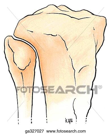 Proximal tibiofibular joint, anterolateral views. View Large Illustration Stock Illustration - Proximal tibiofibular joint, anterolateral views.. Fotosearch