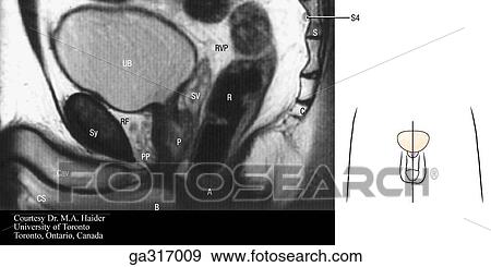 Sagittal MRI (magnetic resonance image) of the male pelvis. Insert image indicates level of MRI. View Large Illustration Stock Illustration - Sagittal MRI (magnetic resonance image) of the male pelvis. Insert image indicates level of MRI.. Fotosearch