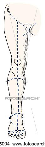 Skin Incisions. View Large Illustration Stock Illustration - Skin Incisions.. Fotosearch