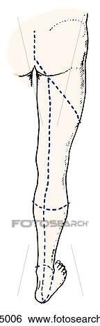 Skin Incisions. View Large Illustration Stock Illustration - Skin Incisions.. Fotosearch