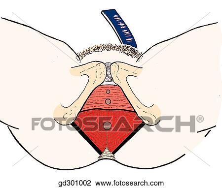 The inferior pelvic aperture is divided into two triangles and effectively closed by the soft structures of the pelvic floor. View Large Illustration Drawing - The inferior pelvic aperture is divided into two triangles and effectively closed by the soft structures of the pelvic floor.. Fotosearch
