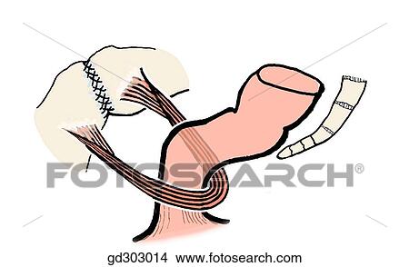 The puborectal sling, the thickened portions of the right and left pubococcygeus muscles uniting posterior to the rectum. View Large Illustration Stock Illustration - The puborectal sling, the thickened portions of the right and left pubococcygeus muscles uniting posterior to the rectum.. Fotosearch