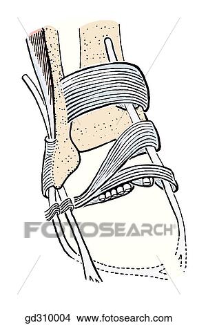 The retinacula hold tendons in place. View Large Illustration Stock Illustration - The retinacula hold tendons in place.. Fotosearch