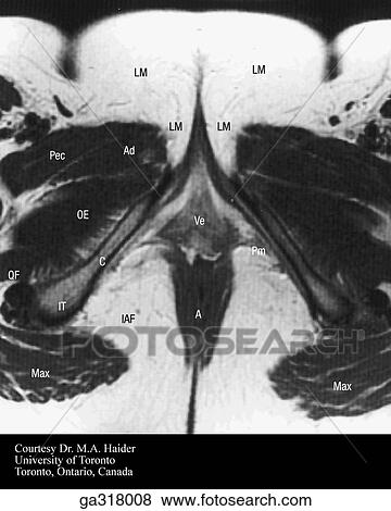 Stock Illustration - Transverse (axial) MRIs of the female pelvis and perineum. E.. Fotosearch