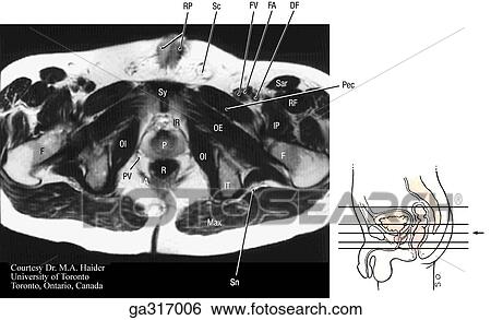 Transverse (axial) MRIs of the male pelvis and perineum. C. View Large Illustration Stock Illustration - Transverse (axial) MRIs of the male pelvis and perineum. C.. Fotosearch