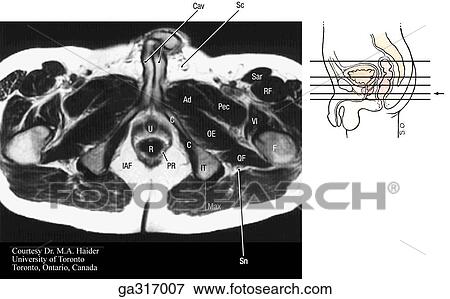 Stock Illustration - Transverse (axial) MRIs of the male pelvis and perineum. D. Insert image indicates level of MRI.. Fotosearch